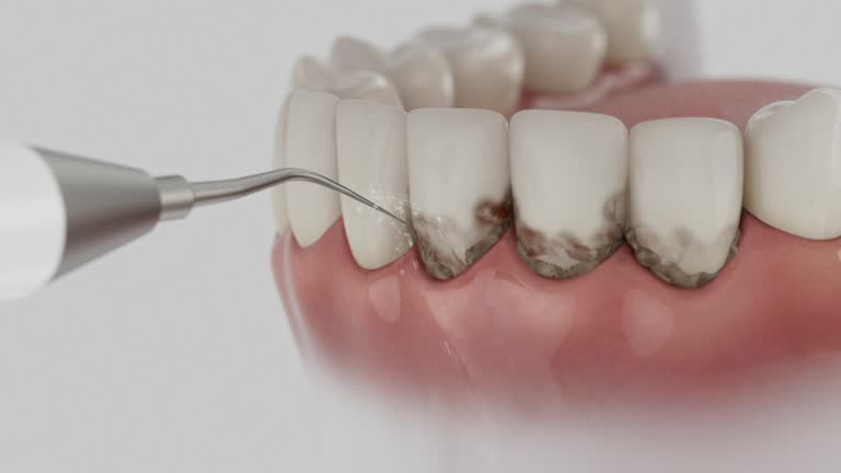 Reliable Teeth Cleaning And Checkup contractor in Robeson County County, NC by Dentist Open Now